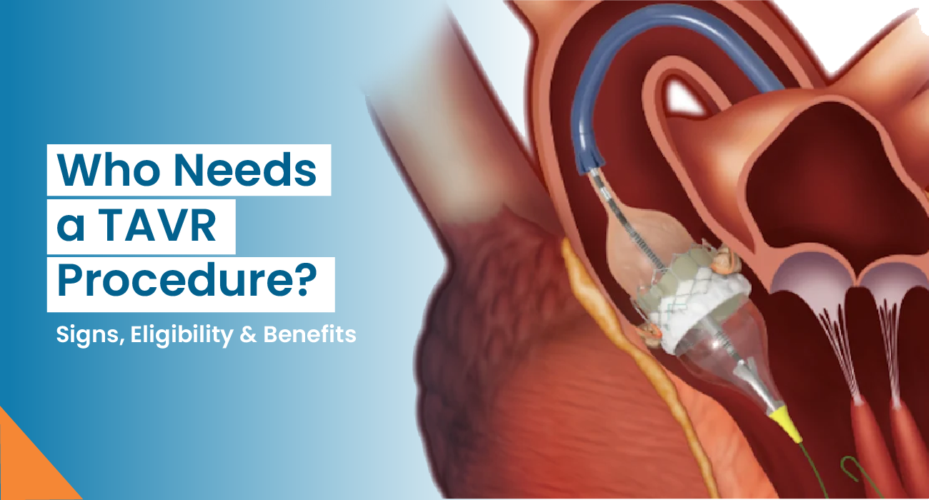 Who Needs a TAVR Procedure? Signs, Eligibility & Benefits